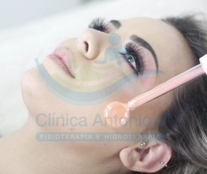 Estética