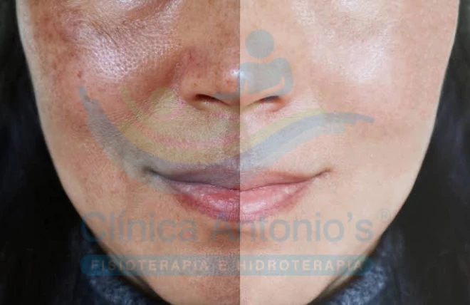 Estou com manchas, o que devo fazer?