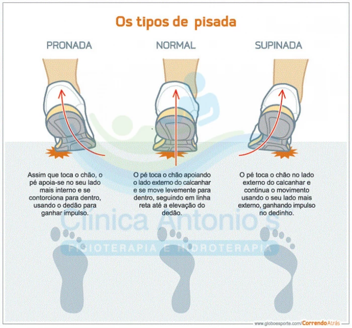 Palmilha Postural - Tipos de pisada