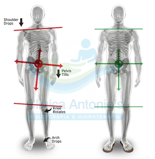 Palmilha Postural - Alterações na postura e o reflexo na posição dos pés