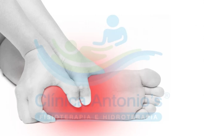 Palmilhas para fascite plantar