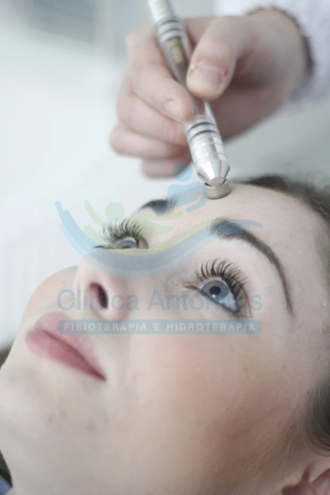 Peeling de Diamante e Peeling de Cristal