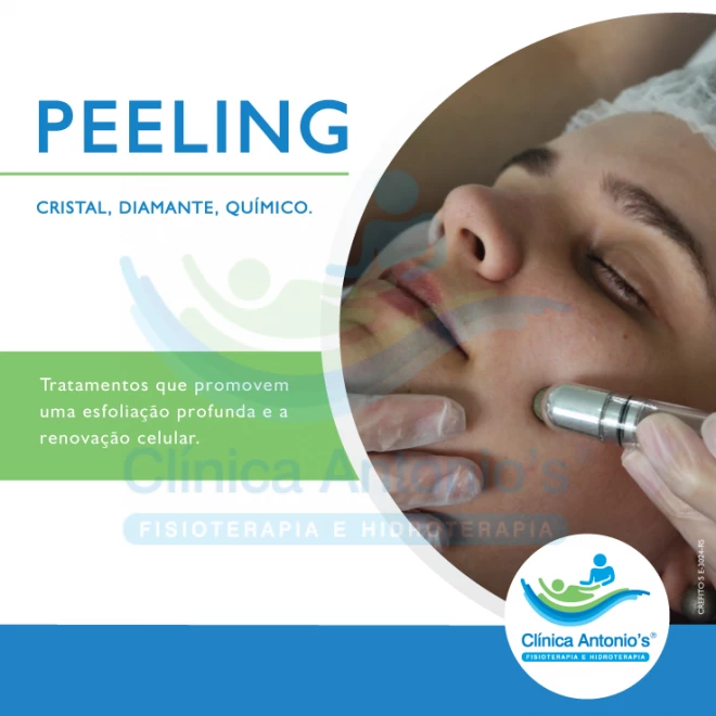 Peelings Químicos e suas indicações