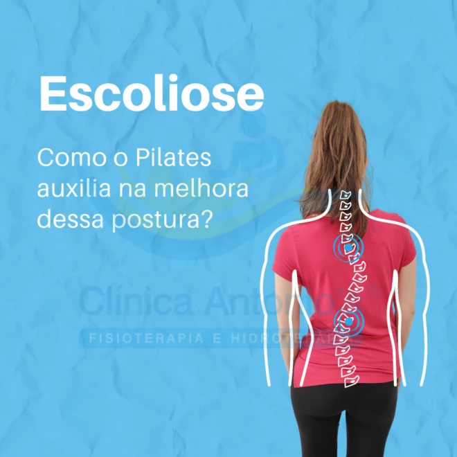 Pilates no tratamento da escoliose