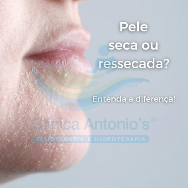 Qual a diferença entre ter a pele seca e ressecada?