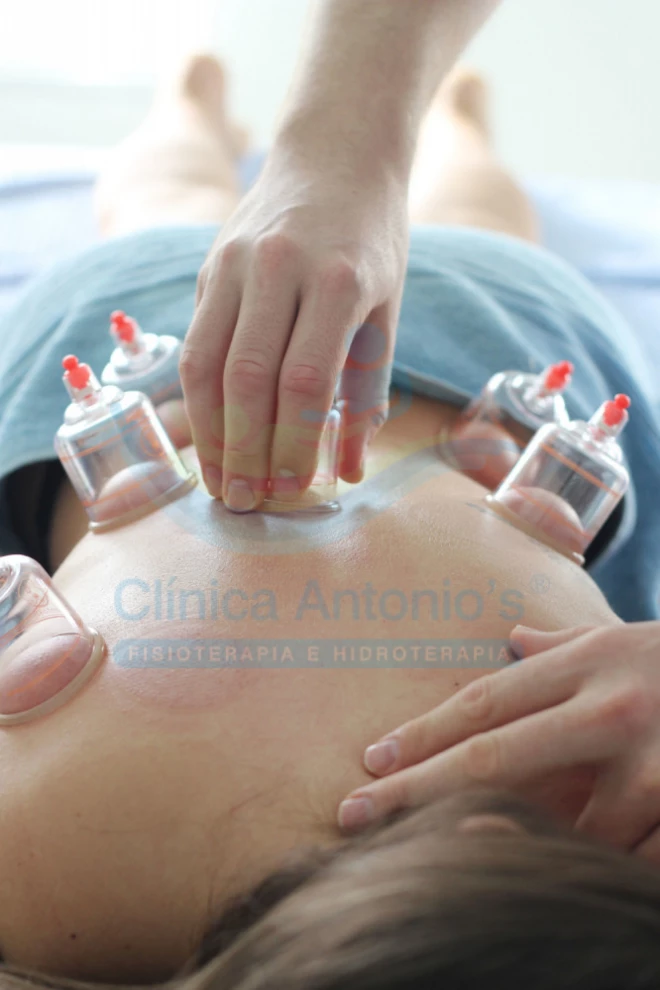 Ventosaterapia aliada ao Pilates